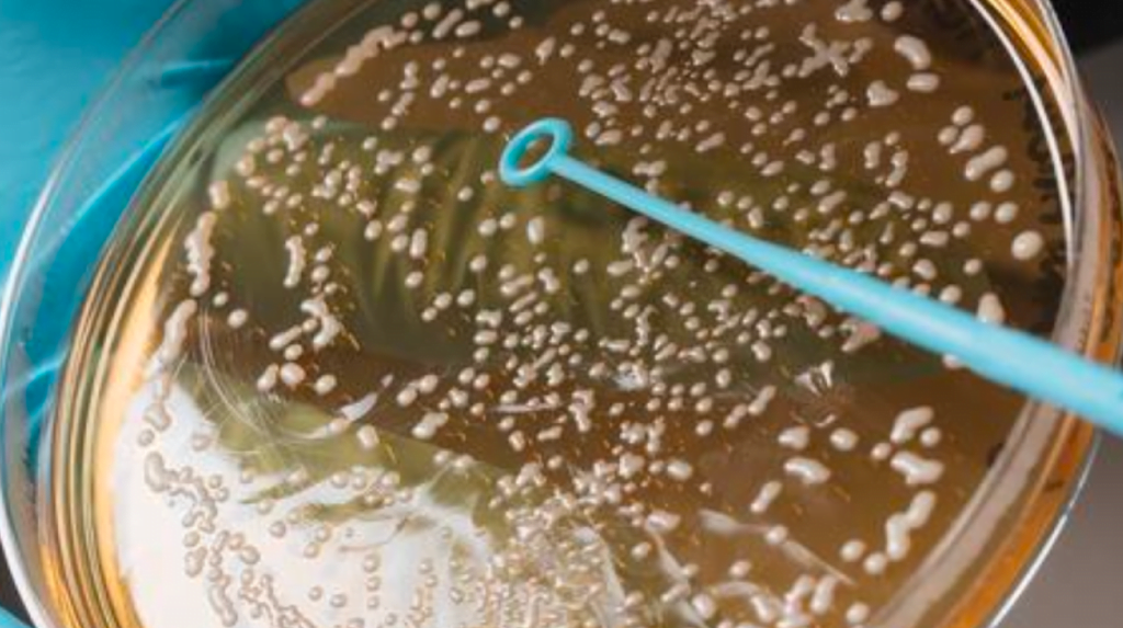 LEVADURAS-NO-SACCHAROMYCES